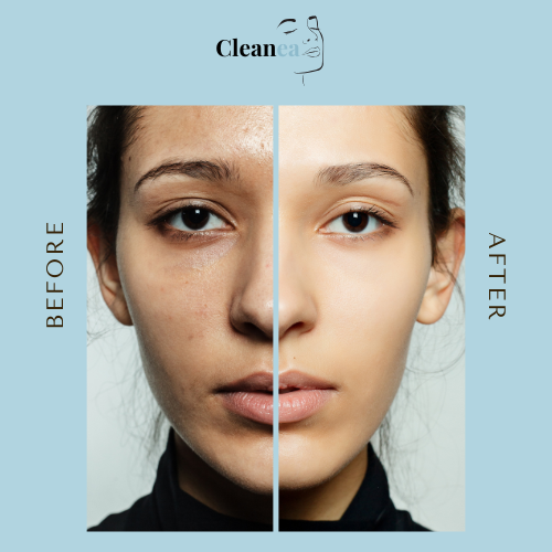 Nettoyeur Profond Ultime - Cleanea